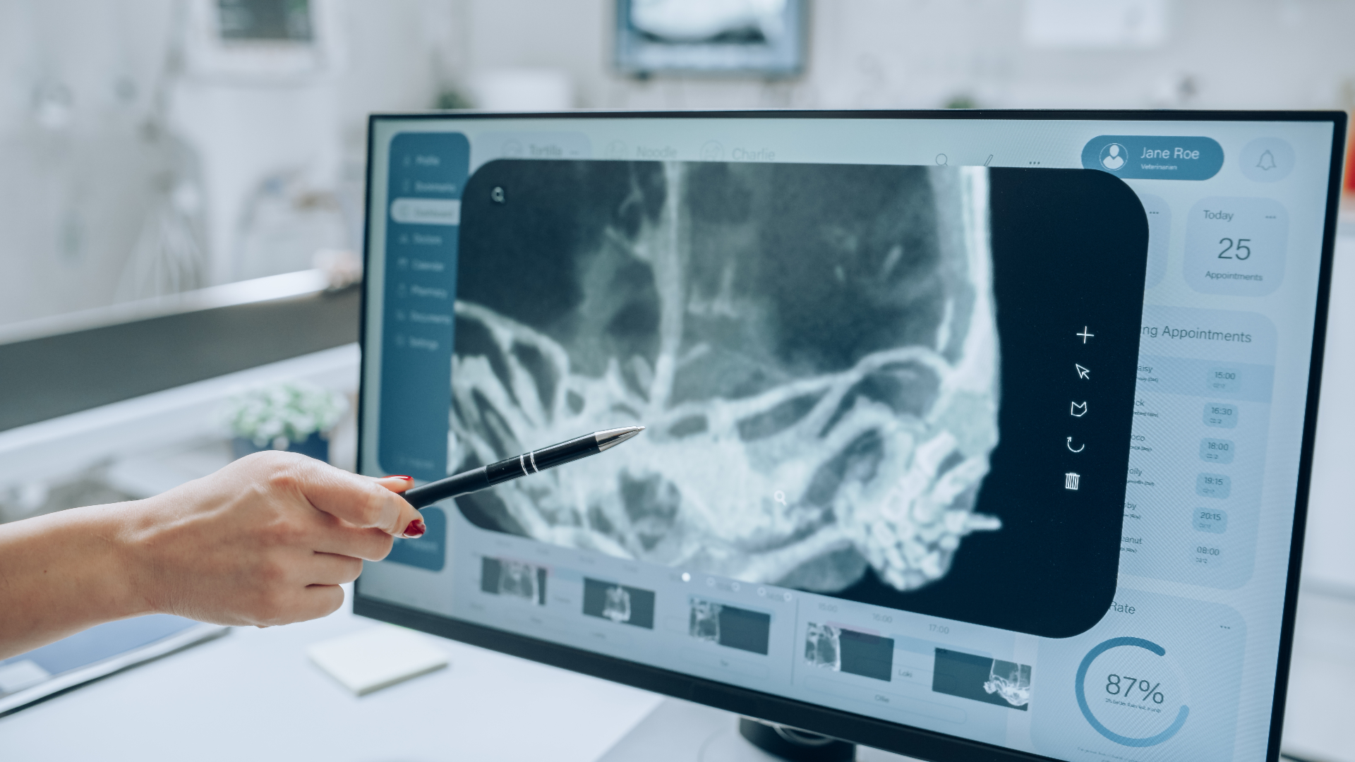 X-ray analysis